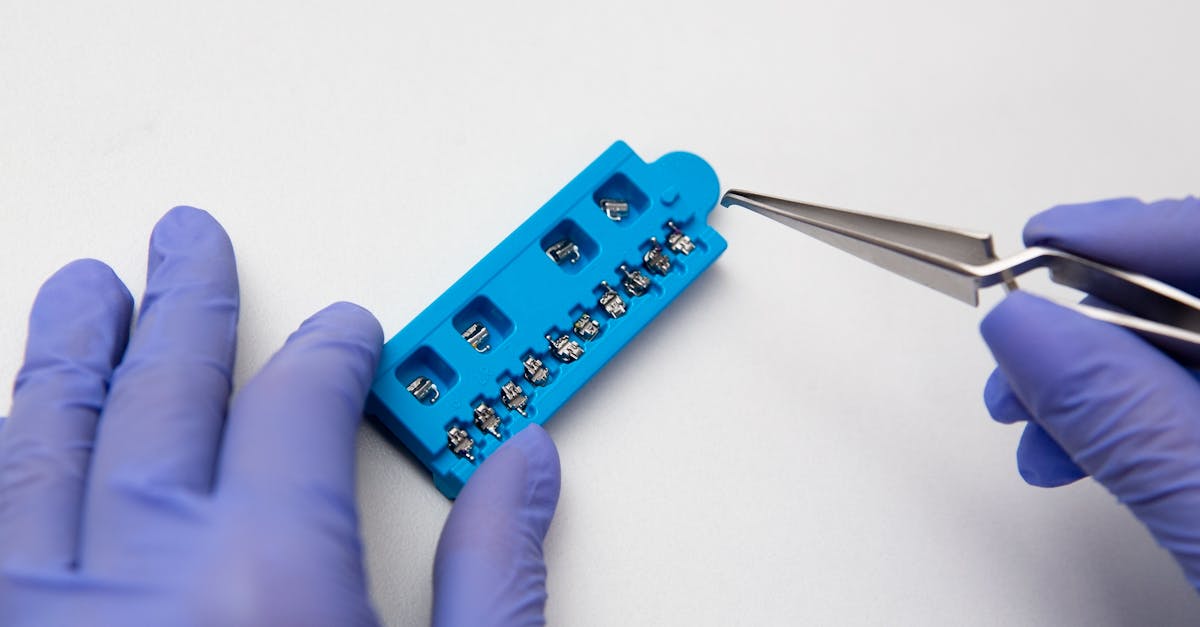 hands of dentist in lilac latex medical gloves with dental tweezers and set of metal brace system